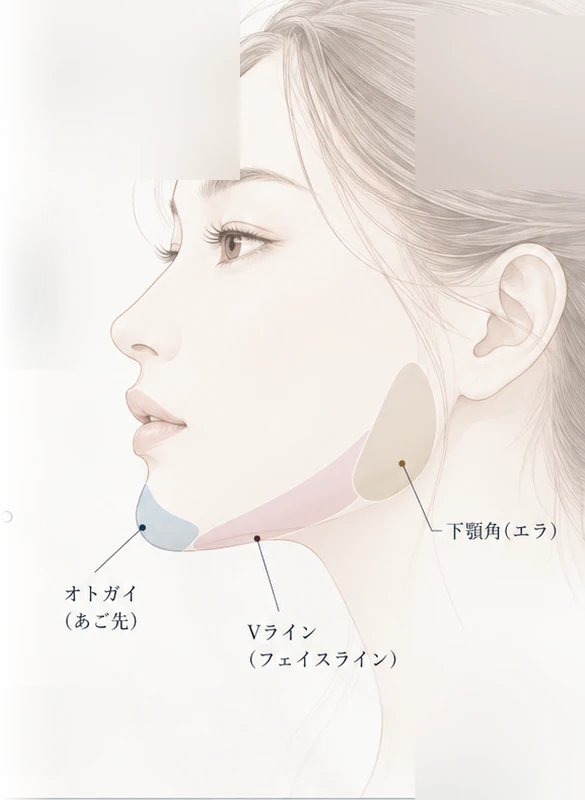 輪郭形成の施術部位イメージイラスト