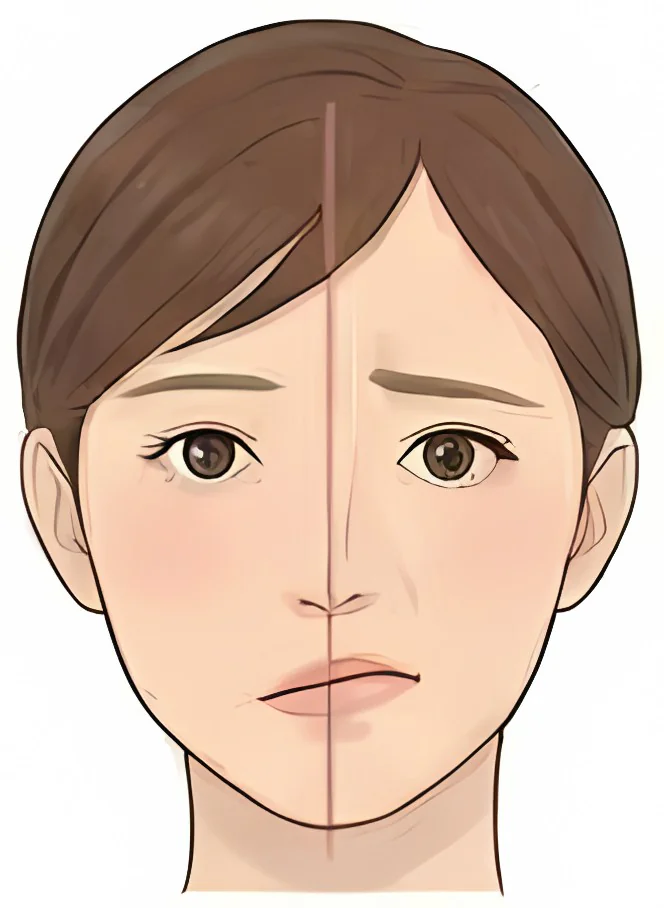 顔面非対称の正面の顔のイメージ図