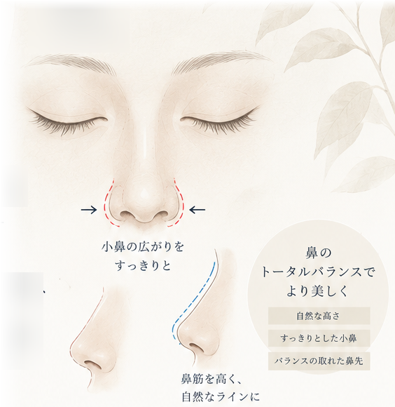 鼻の施術イメージイラスト