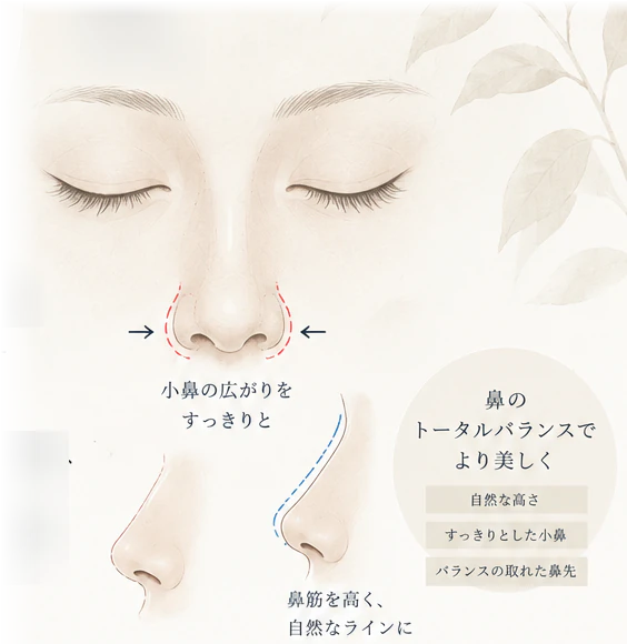 鼻の施術イメージイラスト