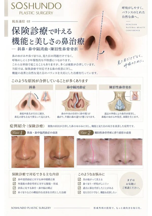 院長通信 Vol.3 保険診療で叶える機能と美しさの鼻治療 ―斜鼻・鼻中隔湾曲・陳旧性鼻骨骨折―の紙面