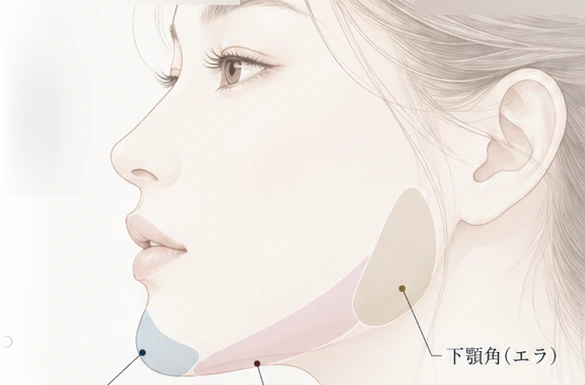 輪郭形成の施術イメージ